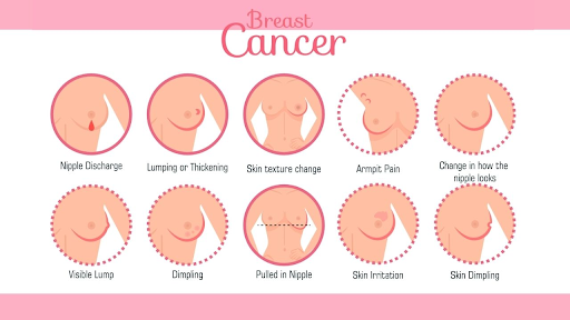 What is breast cancer?